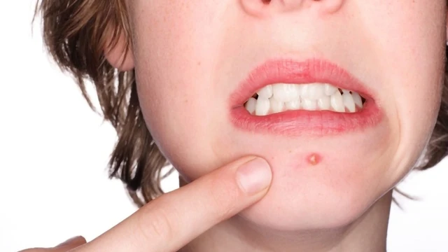 bai-viet/mun-dinh-rau-co-gay-nguy-hiem-hay-khong.html