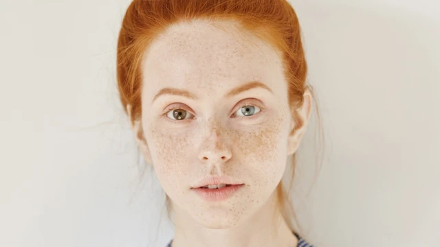 bai-viet/nam-canh-buom-la-gi-tim-hieu-nguyen-nhan-va-phuong-an-dieu-tri-nam-canh-buom.html