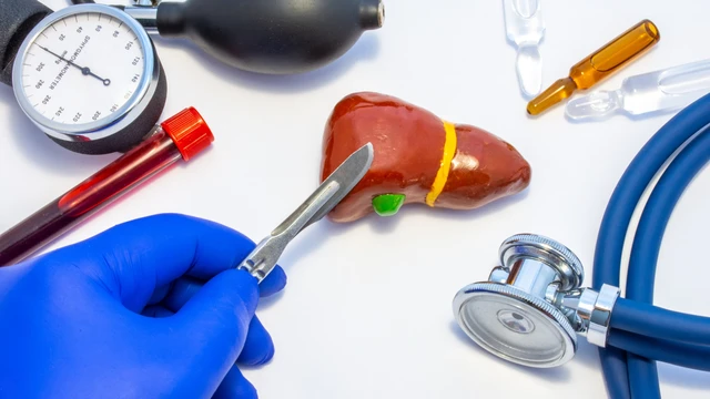 benh/nang-gan-126.html