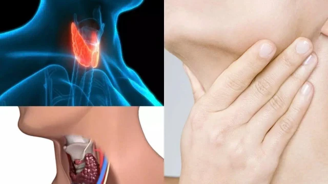 bai-viet/nang-keo-tuyen-giap-nhung-dieu-can-biet.html