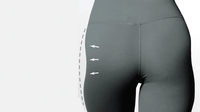 bai-viet/nang-mong-noi-soi-la-gi-khi-nao-can-thuc-hien-nang-mong-noi-soi.html