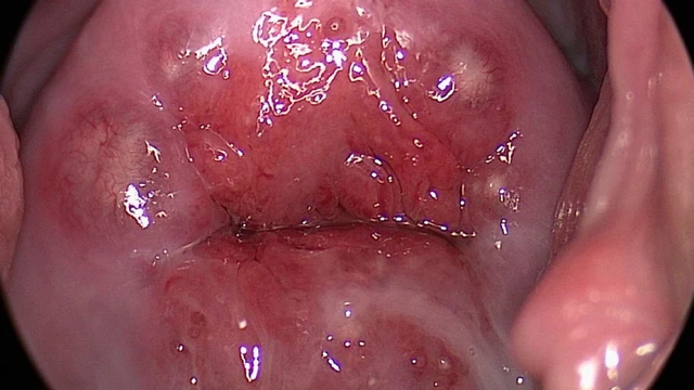 bai-viet/nang-naboth-co-tu-cung-5mm-co-nguy-hiem-khong.html