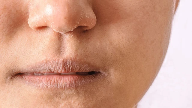 bai-viet/nen-chon-vitamin-va-khoang-chat-gi-de-cai-thien-tinh-trang-da-kho.html