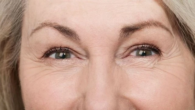 bai-viet/nep-nhan-nguyen-nhan-hinh-thanh-va-dau-hieu-nhan-biet.html