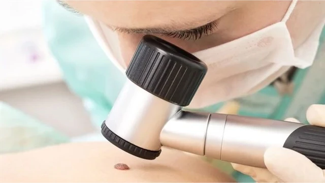 bai-viet/nghien-cuu-xac-dinh-rfc-4-la-tac-nhan-chinh-gay-ung-thu-vom-hong.html