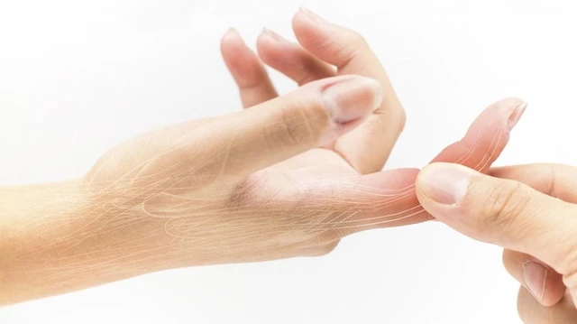 bai-viet/ngon-tay-bi-sung-la-do-benh-gi-va-cach-xu-tri-ra-sao-72664.html