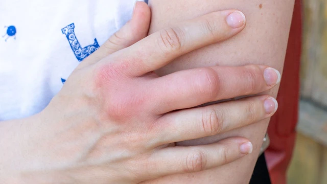 bai-viet/ngon-tay-bi-sung-phu-va-ngua-co-nguy-hiem-khong.html