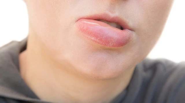 bai-viet/ngu-day-bi-sung-moi-duoi-nguyen-nhan-do-dau.html