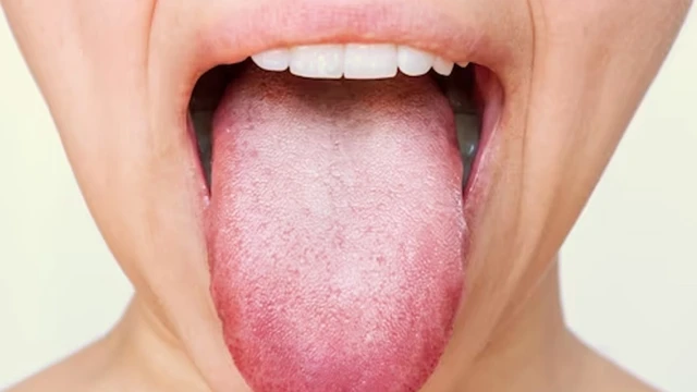 bai-viet/ngua-luoi-trieu-chung-noi-len-suc-khoe-khong-on-dinh-cua-ban.html