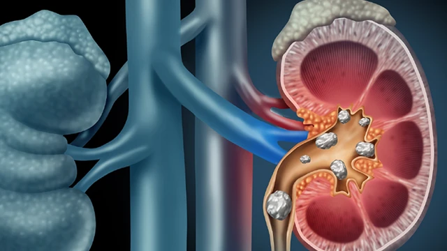 bai-viet/nguoi-bi-soi-than-uong-gi-de-ho-tro-dieu-tri-benh-tot-hon.html