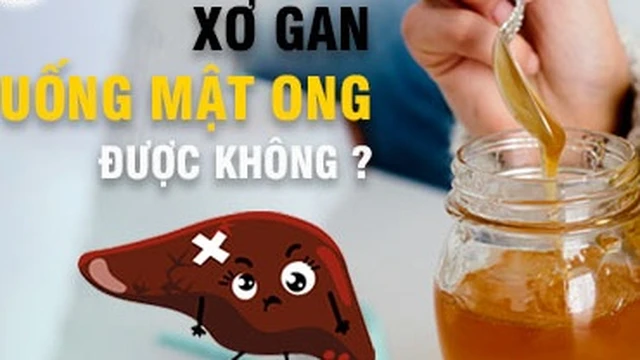 bai-viet/nguoi-bi-xo-gan-co-uong-duoc-mat-ong-khong-71984.html