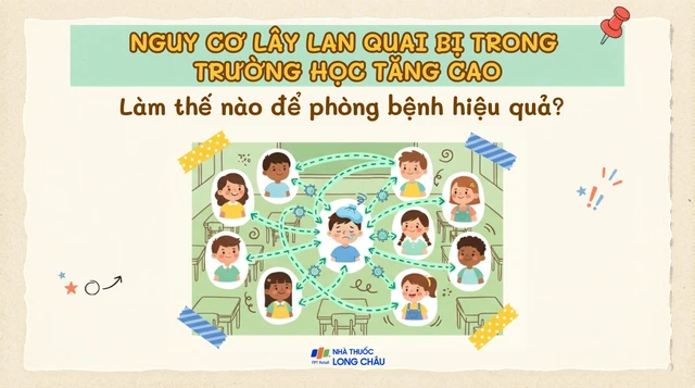 bai-viet/nguy-co-lay-lan-quai-bi-trong-truong-hoc-tang-cao-lam-the-nao-de-phong-ngua-hieu-qua-10009.html