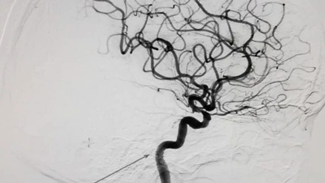 bai-viet/nguyen-ly-chup-mach-so-hoa-xoa-nen-dsa.html