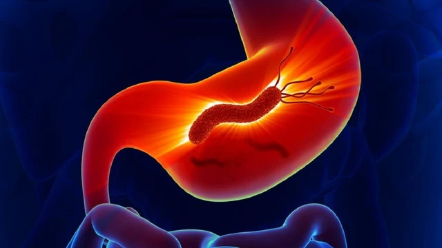 bai-viet/nguyen-nhan-bi-hp-da-day-va-cach-phong-ngua-ban-can-biet.html