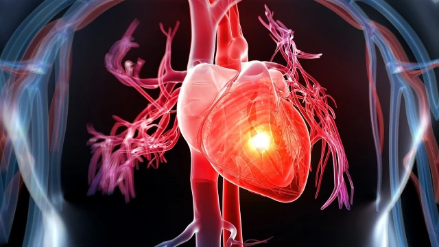 bai-viet/nguyen-nhan-con-dau-tim-va-cach-lam-giam-con-dau-tim-72094.html