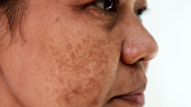 bai-viet/nhung-nguyen-nhan-gay-nam-tan-nhang-co-the-ban-chua-biet.html