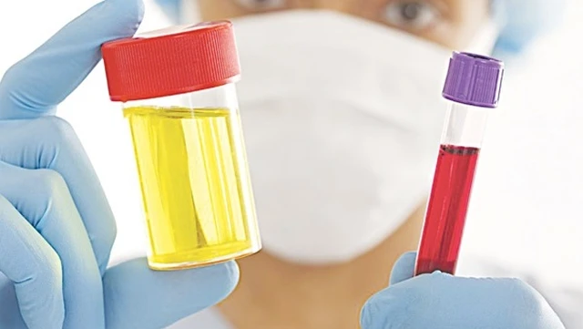 bai-viet/nguyen-nhan-gay-tieu-ra-mau-va-dau-hieu-nhan-biet-benh-ly-61986.html