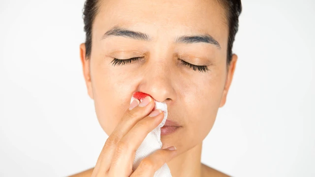 bai-viet/nguyen-nhan-gay-tinh-trang-chay-mau-cam-la-gi.html