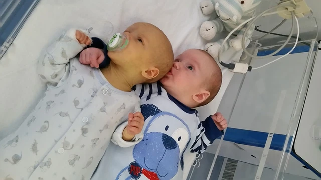 bai-viet/nguyen-nhan-gay-vang-da-benh-ly-la-gi-chua-nhu-the-nao-59650.html