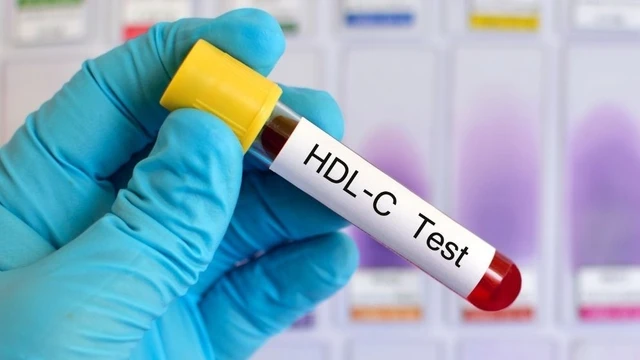 bai-viet/nguyen-nhan-hdl-cholesterol-thap-la-gi-nhung-dieu-can-biet.html