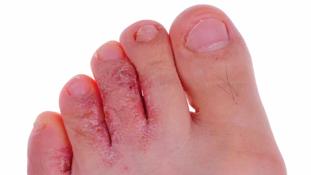 bai-viet/nguyen-nhan-nao-dan-den-ban-chan-bi-lo-ro.html