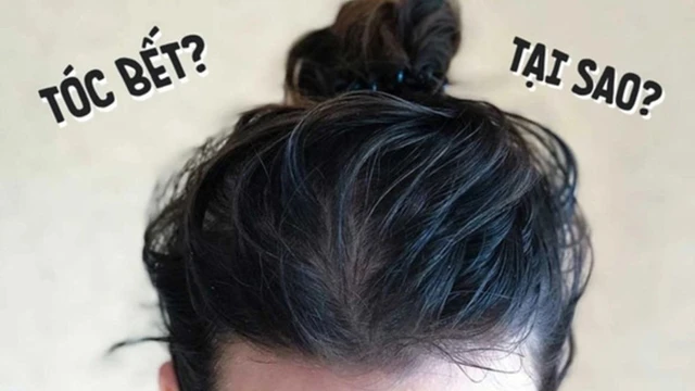 bai-viet/nguyen-nhan-ngu-day-toc-bi-bet.html