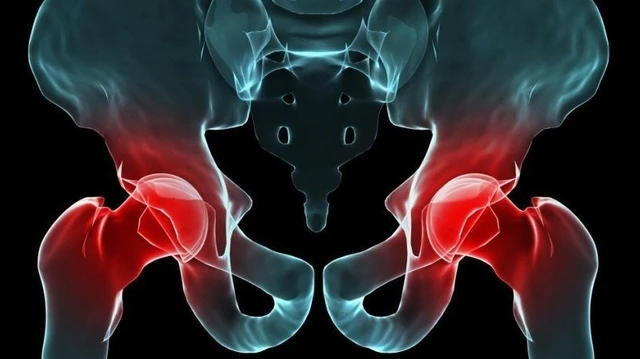 bai-viet/nguyen-nhan-trieu-chung-cach-dieu-tri-viem-khop-hang-nhiem-khuan-52152.html