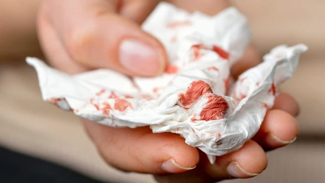 bai-viet/khac-dom-ra-mau-nhung-khong-ho-nguyen-nhan-va-bien-phap-ngan-ngua-la-gi.html