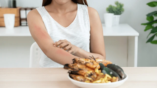 bai-viet/di-ung-thai-ky-nguyen-nhan-va-cach-phong-ngua-danh-cho-me-bau.html