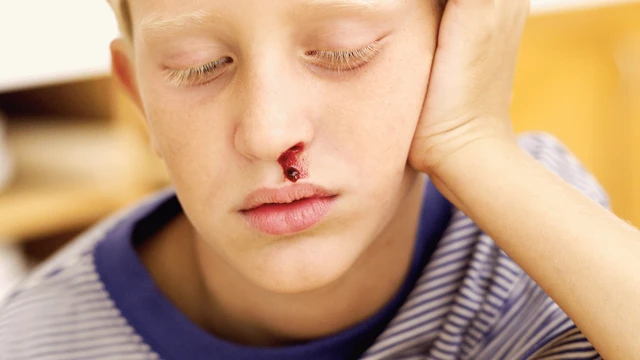 bai-viet/nguyen-nhan-va-cach-xu-ly-tinh-trang-chay-mau-mui-1-ben-trai.html