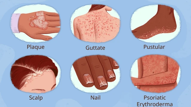 bai-viet/nguyen-nhan-va-trieu-chung-viem-khop-vay-nen-ma-ban-nen-biet.html