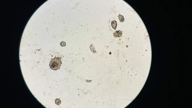 bai-viet/nguyen-tac-dieu-tri-benh-ghe-dung-cach.html