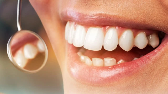 bai-viet/nha-chu-la-gi-cac-benh-thuong-gap-o-nha-chu.html