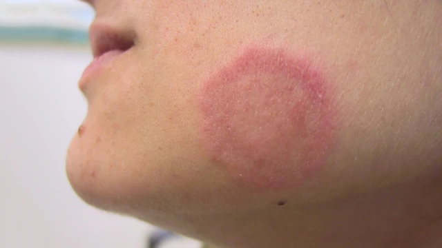 bai-viet/nhan-biet-nhanh-nhung-dau-hieu-cua-benh-hac-lao-o-tre-em-57068.html