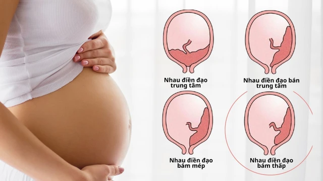 bai-viet/nhau-bam-thap-thuong-toi-tuan-bao-nhieu-thi-het.html