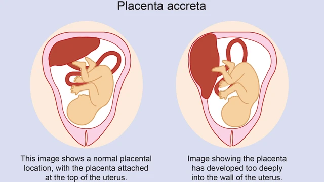benh/nhau-cai-rang-luoc.html