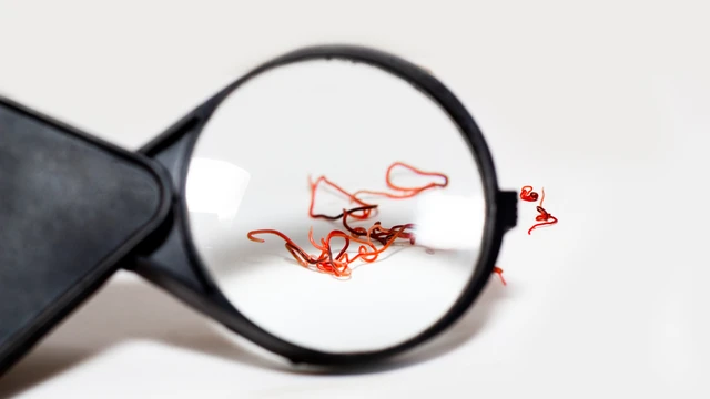 benh/nhiem-echinococcus-194.html