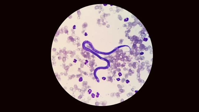 bai-viet/nguoi-co-the-bi-nhiem-ky-sinh-trung-mau-o-cho-khong-dau-hieu-nhan-biet.html