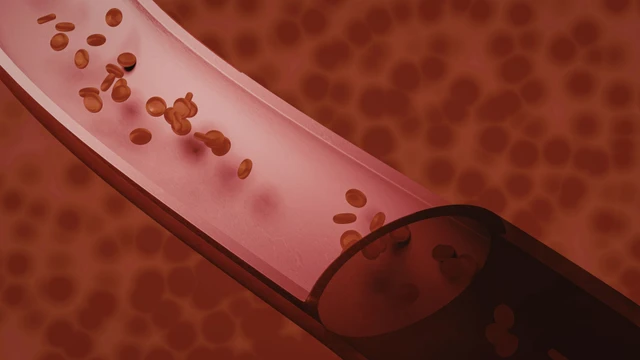 bai-viet/nhiem-trung-mau-o-nguoi-lon-la-gi-co-nguy-hiem-khong.html