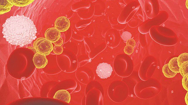 bai-viet/nhiem-trung-mau-sau-phau-thuat-nguy-hiem-nhu-the-nao.html