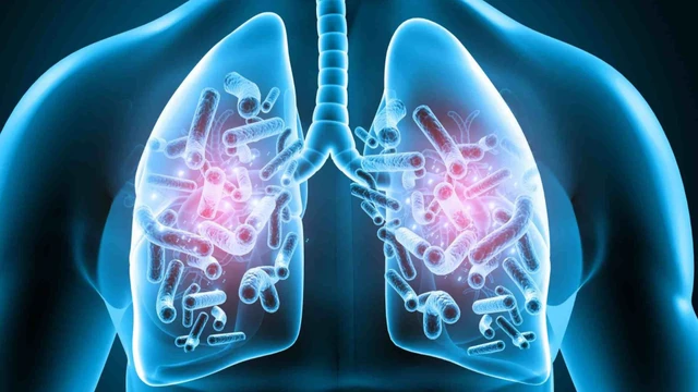 bai-viet/nhiem-trung-phoi-co-lay-khong-muc-do-nguy-hiem-chan-doan-va-dieu-tri.html