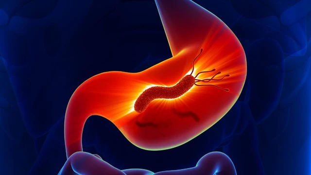 bai-viet/nhiem-vi-khuan-hp-da-day-co-nguy-hiem-khong-bien-phap-phong-ngua-nhiem-hp-da-day.html