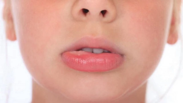 bai-viet/nhiet-mieng-sung-moi-la-gi-nguyen-nhan-va-cach-dieu-tri.html