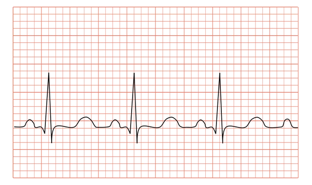 bai-viet/nhip-nhanh-xoang-co-chua-khoi-duoc-hay-khong.html