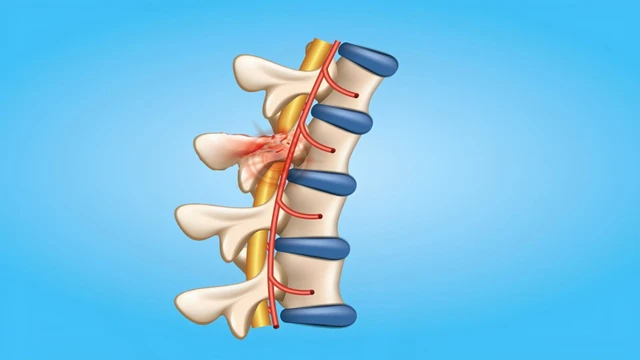 bai-viet/nhoi-mau-tuy-song-trieu-chung-nguyen-nhan-va-cach-dieu-tri.html