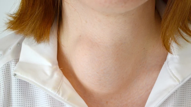 bai-viet/nhung-dau-hieu-buou-co-cach-nhan-biet-va-chan-doan-chinh-xac.html