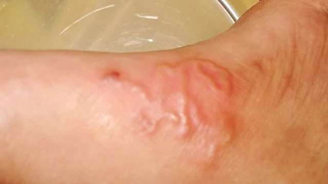 bai-viet/nhung-dau-hieu-nhiem-san-cho-khong-the-bo-qua.html