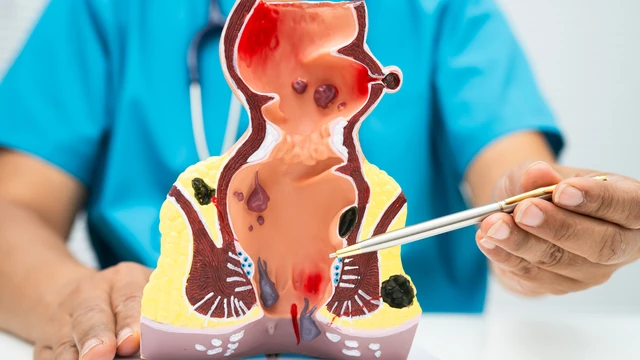 bai-viet/nhung-dau-hieu-tri-noi-va-cach-phong-ngua-chung.html