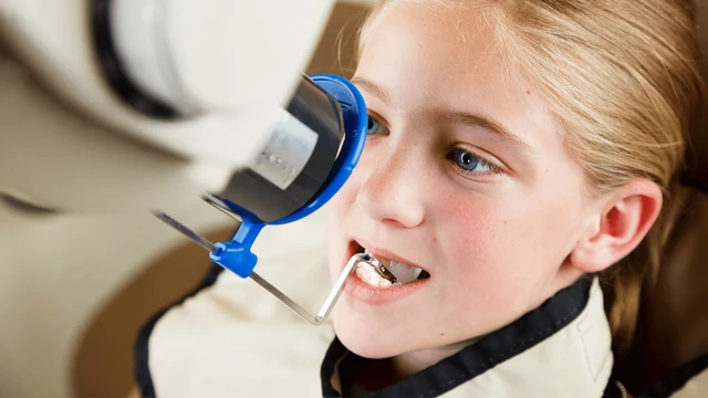 bai-viet/nhung-dieu-ba-me-can-luu-y-khi-chup-x-quang-rang-cho-tre-em.html