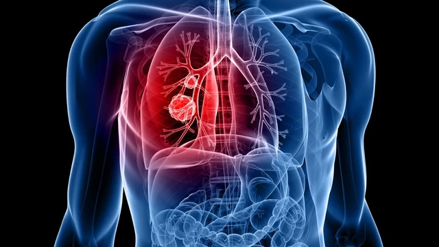 bai-viet/u-phoi-lanh-tinh-la-gi-nguyen-nhan-dau-hieu-va-cach-phong-ngua-hieu-qua.html